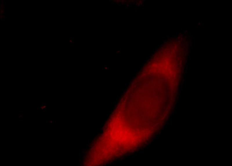 Immunofluorescent analysis of Hela cells, using AMICA1 antibody Catalog No:111883 at 1:25 dilution and Rhodamine-labeled goat anti-rabbit IgG (red).