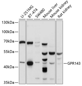 Western blot - GPR143 Polyclonal Antibody 
