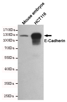 Western blot detection of E-Cadherin in  Mouse embryos and HCT116 cell lysates using E-Cadherin mouse mAb(dilution 1:1000).Predicted band size:135kDa.Observed band size:135kDa.