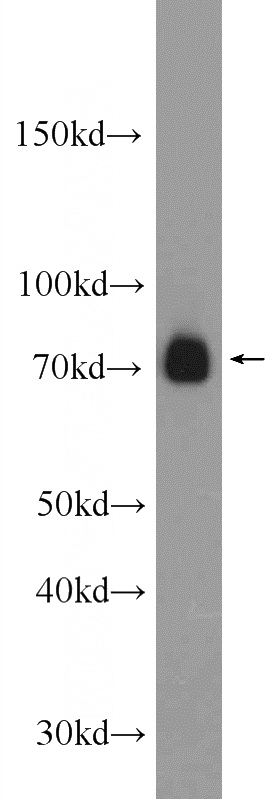 Jurkat cells were subjected to SDS PAGE followed by western blot with Catalog No:116905(ZAP70 Antibody) at dilution of 1:3000