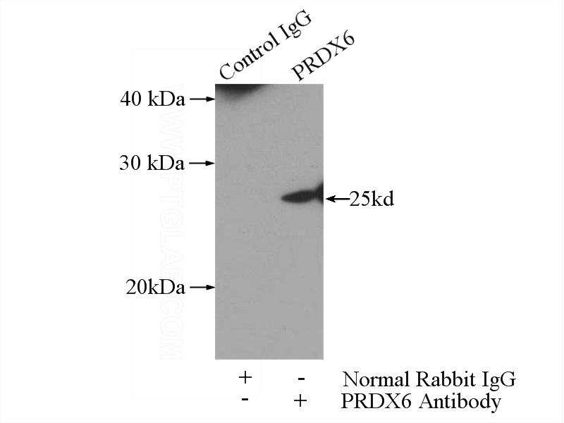 IP Result of anti-PRDX6 (IP:Catalog No:114178, 3ug; Detection:Catalog No:114178 1:500) with HeLa cells lysate 2800ug.