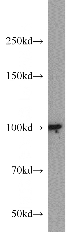 K-562 cells were subjected to SDS PAGE followed by western blot with Catalog No:109822(DDX23 antibody) at dilution of 1:1000
