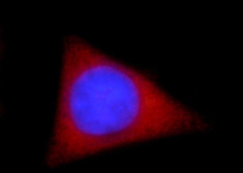 Immunofluorescent analysis of HepG2 cells, using MAST3 antibody Catalog No:112491 at 1:25 dilution and Rhodamine-labeled goat anti-rabbit IgG (red). Blue pseudocolor = DAPI (fluorescent DNA dye).