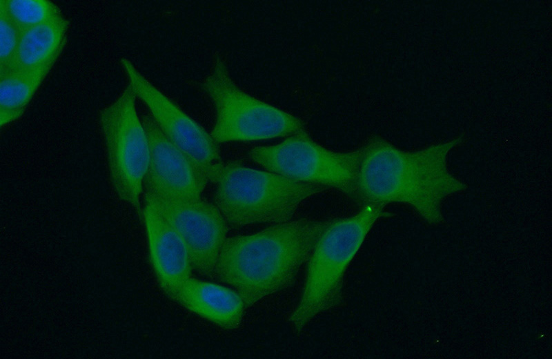 Immunofluorescent analysis of (10% Formaldehyde) fixed HeLa cells using Catalog No:109934(DHX57 Antibody) at dilution of 1:50 and Alexa Fluor 488-congugated AffiniPure Goat Anti-Rabbit IgG(H+L)
