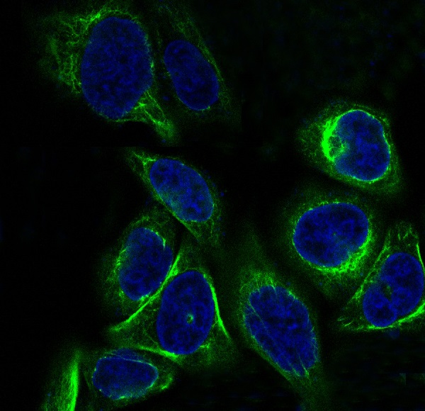 Immunofluorescent analysis of Hela cells, using Cytokeratin 7 Antibody.