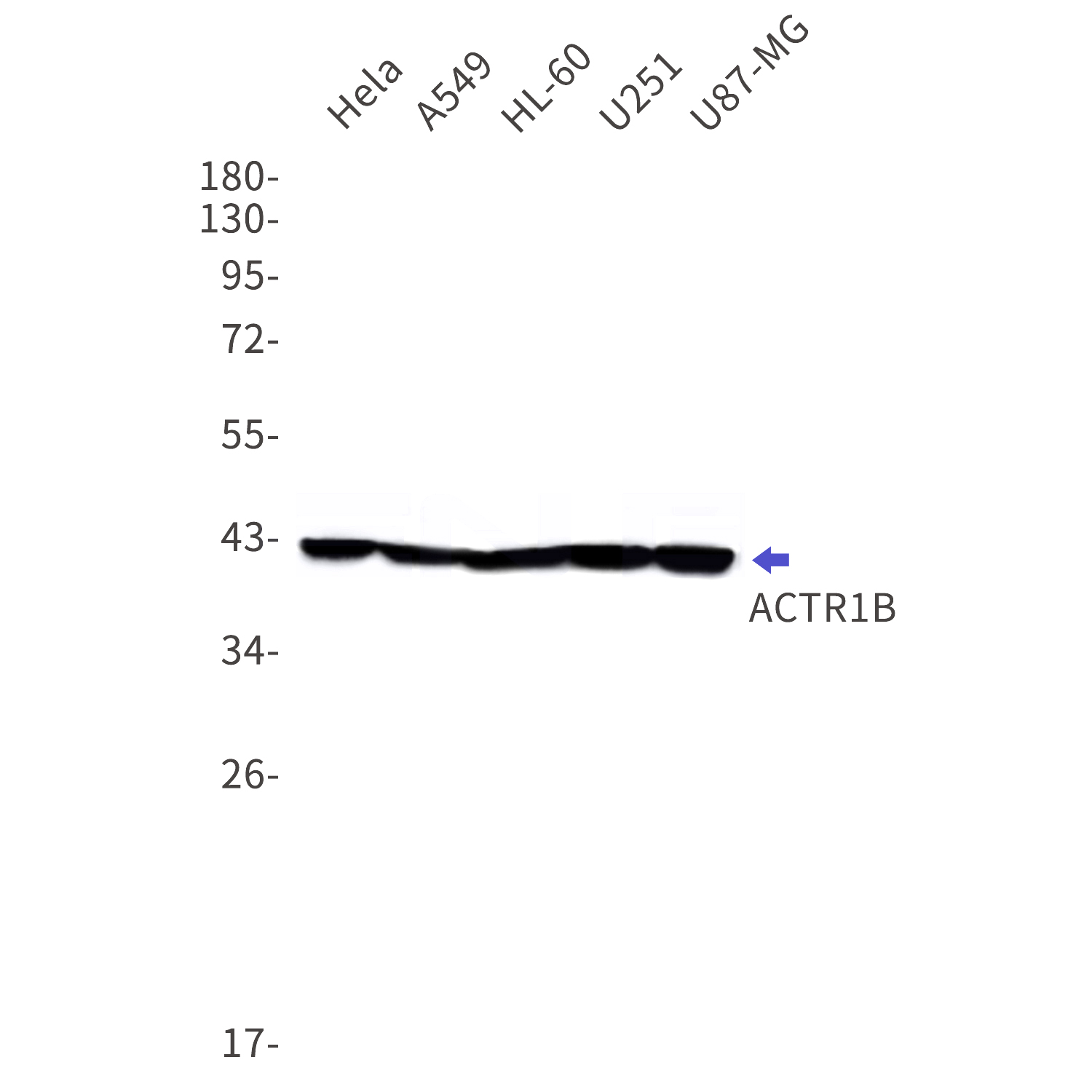 Western blot detection of ACTR1B in Hela,A549,HL-60,U251,U87-MG cell lysates using ACTR1B Rabbit mAb(1:1000 diluted).Predicted band size:42kDa.Observed band size:42kDa.