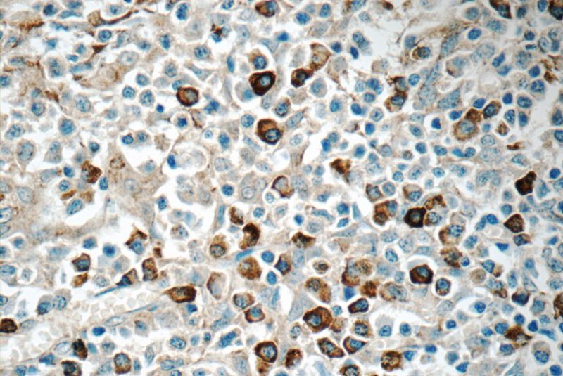 Immunohistochemistry of paraffin-embedded human tonsillitis tissue slide using Catalog No:116225(TRA- Antibody) at dilution of 1:50 (under 40x lens)