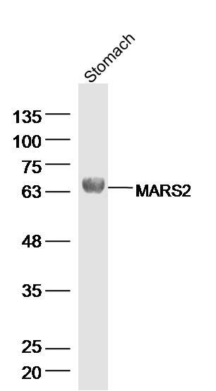 Fig1: Sample: Stomach (Rat) Lysate at 40 ug; Primary: Anti-MARS2 at 1/300 dilution; Secondary: IRDye800CW Goat Anti-Rabbit IgG at 1/20000 dilution; Predicted band size: 63 kD; Observed band size: 65 kD