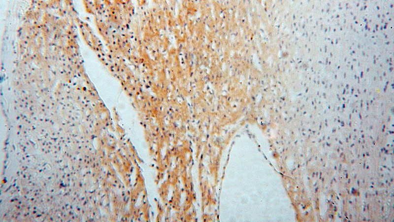 Immunohistochemical of paraffin-embedded human heart using Catalog No:113035(NCF4 antibody) at dilution of 1:50 (under 10x lens)