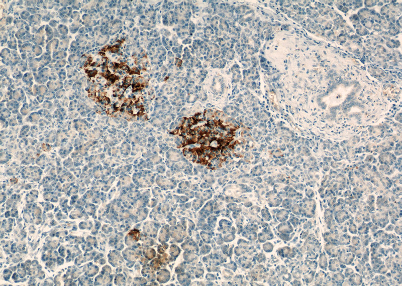 Immunohistochemical of paraffin-embedded human pancreas using Catalog No:116273(TMED10 antibody) at dilution of 1:50 (under 10x lens)