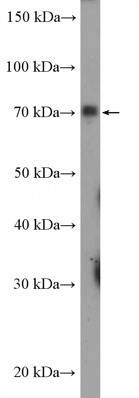 A549 cells were subjected to SDS PAGE followed by western blot with Catalog No:115169(SLC5A2 Antibody) at dilution of 1:600
