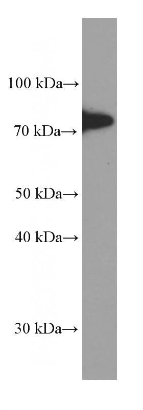 pig spleen tissue were subjected to SDS PAGE followed by western blot with Catalog No:107573(ALOX5 Antibody) at dilution of 1:2000