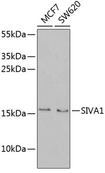 Western blot - SIVA1 Polyclonal Antibody 