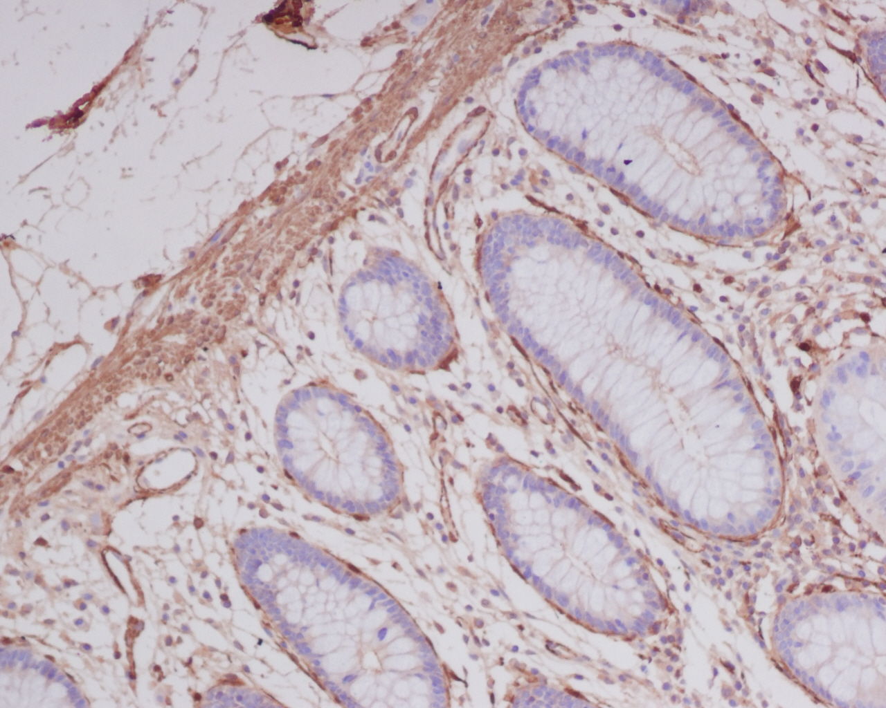 Immunohistochemical analysis of paraffin-embedded human colon, using alpha smooth muscle Actin Antibody.