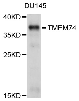 Western blot - TMEM74 Polyclonal Antibody 