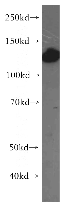 COLO 320 cells were subjected to SDS PAGE followed by western blot with Catalog No:111355(HIP1-Specific antibody) at dilution of 1:300