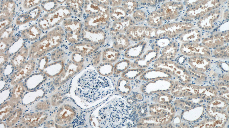 Immunohistochemistry of paraffin-embedded human kidney tissue slide using Catalog No:107950(AKT3 Antibody) at dilution of 1:50 (under 10x lens)