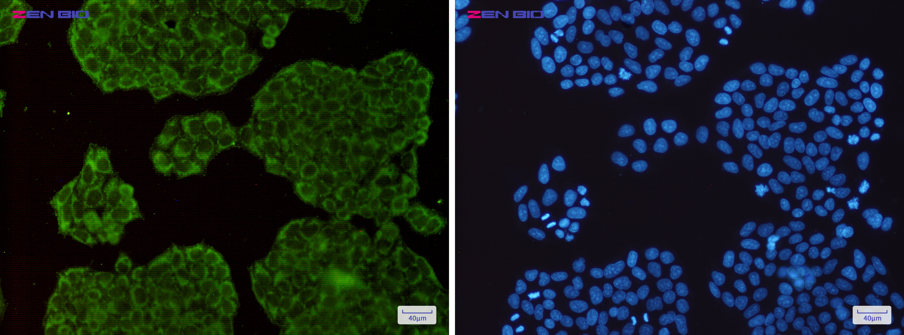 Immunocytochemistry of rSec6(green) in Hela cells using rSec6 Rabbit mAb at dilution 1/200, and DAPI(blue)