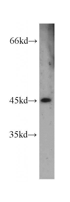 human placenta tissue were subjected to SDS PAGE followed by western blot with Catalog No:110953(GFRA2 antibody) at dilution of 1:200