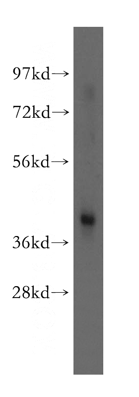 mouse testis tissue were subjected to SDS PAGE followed by western blot with Catalog No:116498(TWF1 antibody) at dilution of 1:200