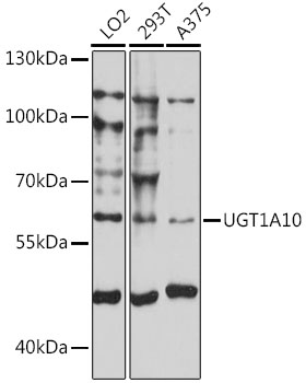 Western blot - UGT1A10 Polyclonal Antibody 