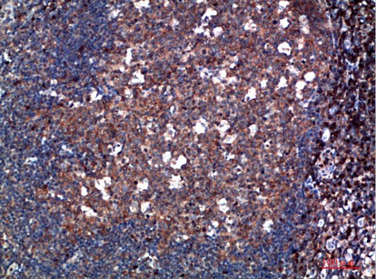 Fig2:; Immunohistochemical analysis of paraffin-embedded human-tonsil, antibody was diluted at 1:200
