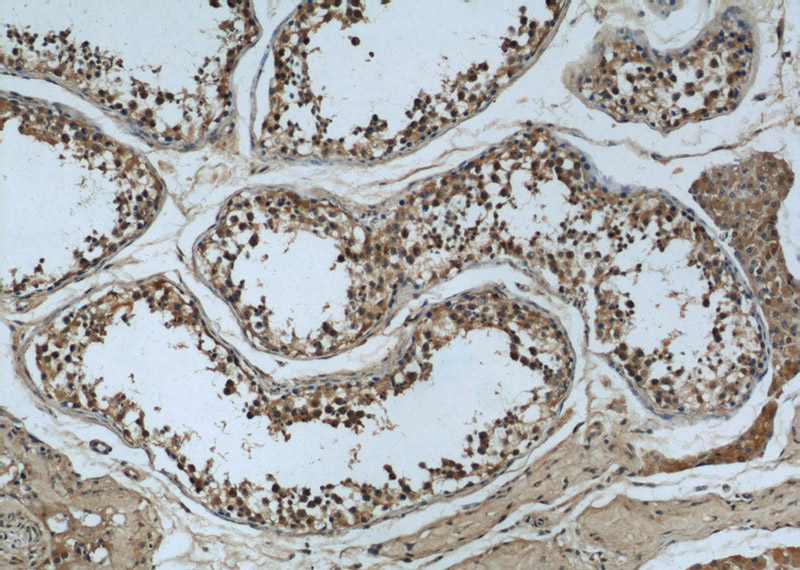 Immunohistochemistry of paraffin-embedded human testis slide using Catalog No:107410(MAD2L1 Antibody) at dilution of 1:50