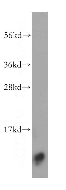 human testis tissue were subjected to SDS PAGE followed by western blot with Catalog No:114952(S100B antibody) at dilution of 1:400