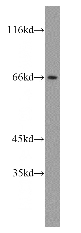HEK-293 cells were subjected to SDS PAGE followed by western blot with Catalog No:108740(CA9 antibody) at dilution of 1:1000