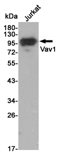 Western blot detection of Vav1 in Jurkat cell lysates using Vav1 mouse mAb (1:3000 diluted).Predicted band size:98KDa.Observed band size:95KDa.