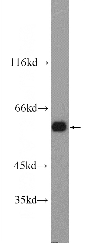 Jurkat cells were subjected to SDS PAGE followed by western blot with Catalog No:108333(ATL3 Antibody) at dilution of 1:1500