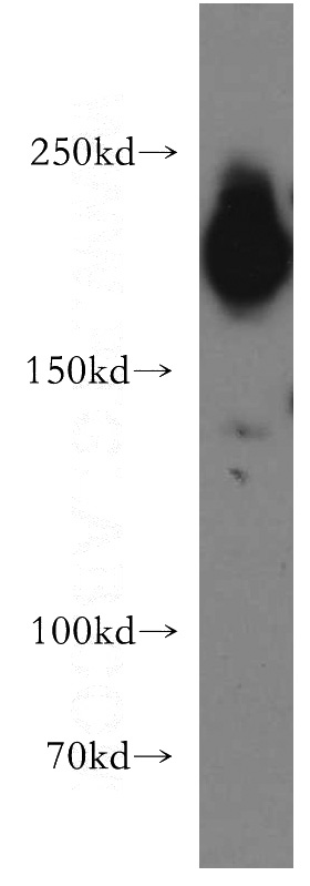 A375 cells were subjected to SDS PAGE followed by western blot with Catalog No:113817(PHIP antibody) at dilution of 1:3000