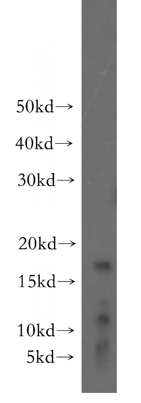 mouse brain tissue were subjected to SDS PAGE followed by western blot with Catalog No:110971(TSC22D3 antibody) at dilution of 1:500