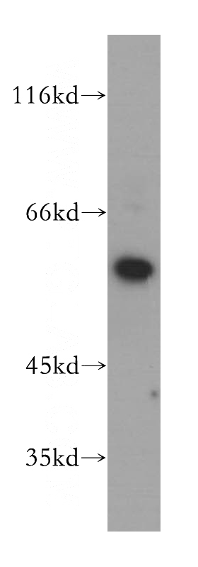 HEK-293 cells were subjected to SDS PAGE followed by western blot with Catalog No:109911(DGKE antibody) at dilution of 1:400