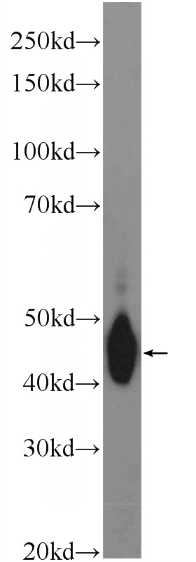 human plasma tissue were subjected to SDS PAGE followed by western blot with Catalog No:108729(C4BPB Antibody) at dilution of 1:600