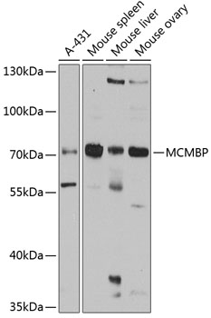 Western blot - MCMBP Polyclonal Antibody 