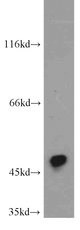 mouse liver tissue were subjected to SDS PAGE followed by western blot with Catalog No:109691(CYP2A6 antibody) at dilution of 1:500