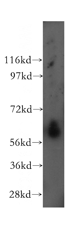 human lung tissue were subjected to SDS PAGE followed by western blot with Catalog No:111466(HRPT2; CDC73 antibody) at dilution of 1:500