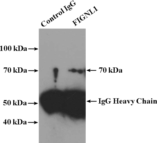 IP Result of anti-FIGNL1 (IP:Catalog No:110664, 4ug; Detection:Catalog No:110664 1:1000) with HeLa cells lysate 2680ug.