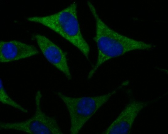 Fig2:; ICC staining of SLC8B1 in SHSY5Y cells (green). Formalin fixed cells were permeabilized with 0.1% Triton X-100 in TBS for 10 minutes at room temperature and blocked with 1% Blocker BSA for 15 minutes at room temperature. Cells were probed with the primary antibody ( 1/100) for 1 hour at room temperature, washed with PBS. Alexa Fluor®488 Goat anti-Rabbit IgG was used as the secondary antibody at 1/100 dilution. The nuclear counter stain is DAPI (blue).
