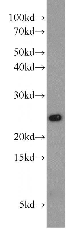 Jurkat cells were subjected to SDS PAGE followed by western blot with Catalog No:114382(PSMB2 antibody) at dilution of 1:800