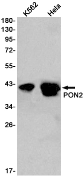 Western blot detection of PON2 in K562,Hela cell lysates using PON2 Rabbit pAb(1:1000 diluted).Predicted band size:39kDa.Observed band size:40-42kDa.