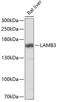 Western blot - LAMB3 Polyclonal Antibody 