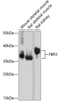 Western blot - FBP2 Polyclonal Antibody 
