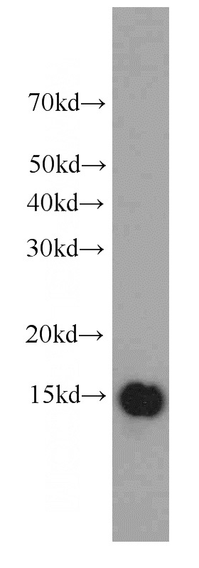 HeLa cells were subjected to SDS PAGE followed by western blot with Catalog No:107277(IFITM3 antibody) at dilution of 1:1000