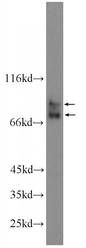 HepG2 cells were subjected to SDS PAGE followed by western blot with Catalog No:107697(ACSL4 Antibody) at dilution of 1:1000