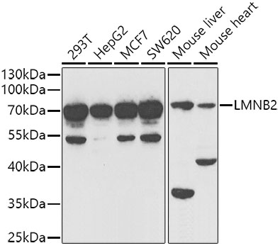 Western blot - LMNB2 Polyclonal Antibody 