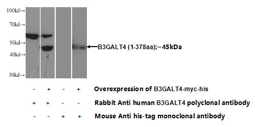 Transfected HEK-293 cells were subjected to SDS PAGE followed by western blot with Catalog No:117088(B3GALT4 Antibody) at dilution of 1:1000