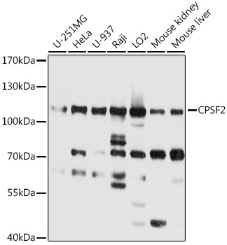 Western blot - CPSF2 Polyclonal Antibody 