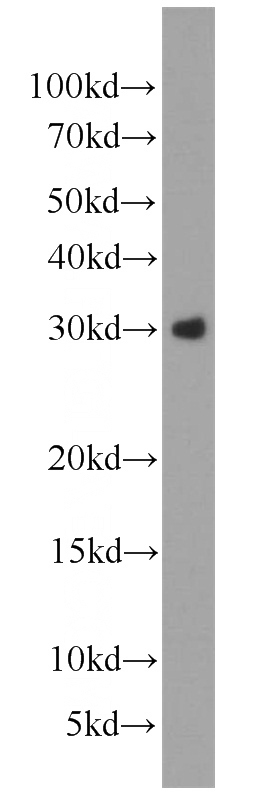 HEK-293 cells were subjected to SDS PAGE followed by western blot with Catalog No:116821(WFDC1 antibody) at dilution of 1:1000